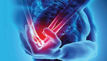 Prevención de lesiones músculo-esqueléticas de origen laboral